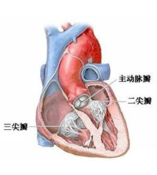 风湿性心脏瓣膜病主要病因
