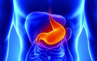 “胃肠间质瘤”究竟是个什么“鬼”